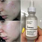 The Ordinary Niacinamide 10% + Zinc 1% 30ml